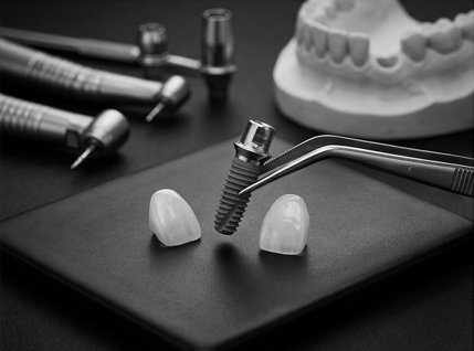 Dental implant with a porcelain crown